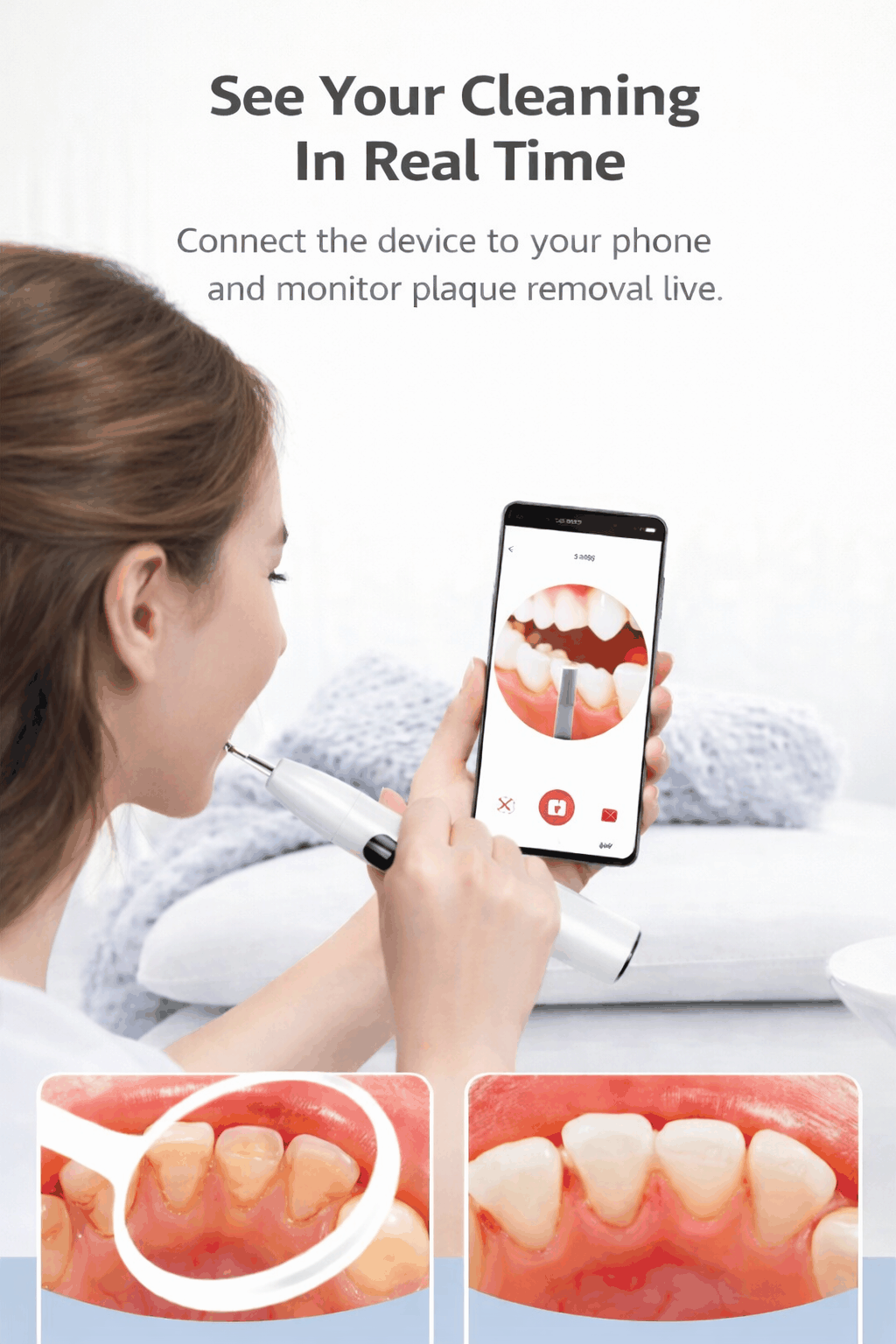 Ultrasonic Teeth Scaling With Camera