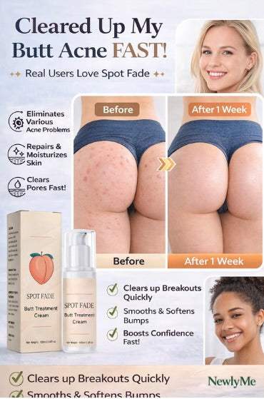 Butt acne cream tube with clear skin benefits and soothing formula for smooth, flawless skin