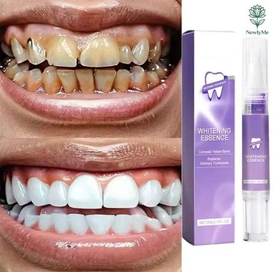 Magical Teeth Whitening Pen