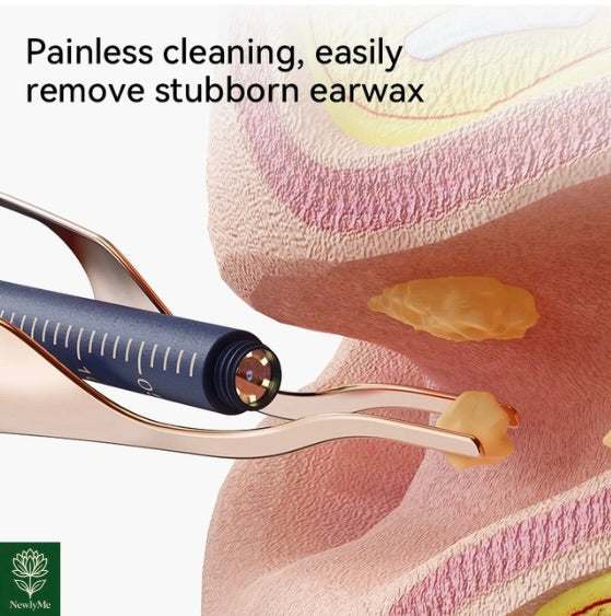 Smart Visual Ear Wax Cleaner