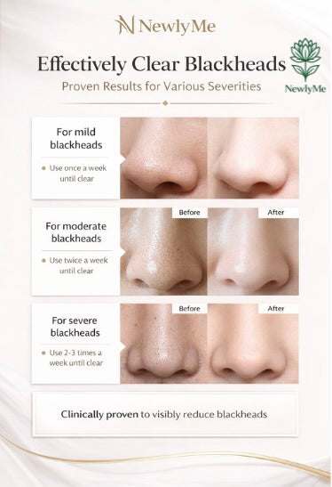 Charcoal Peel-Off Mask