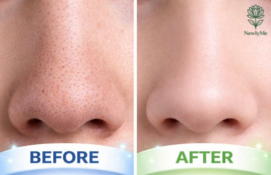 Deep Cleansing Charcoal Nose Strips