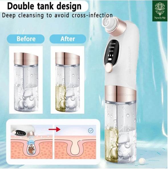 Blackhead Remover Electric Face Cleaner