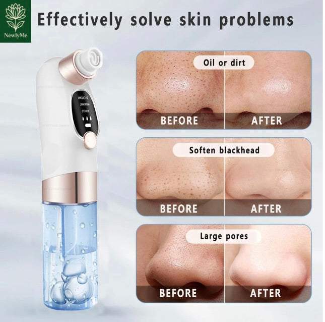 Blackhead Remover Electric Face Cleaner