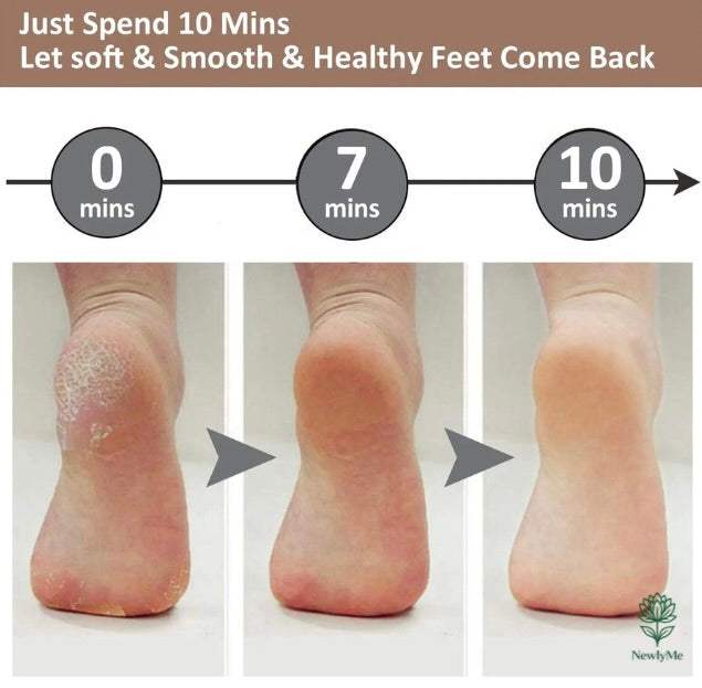 Professional Electric Pedicure Tool