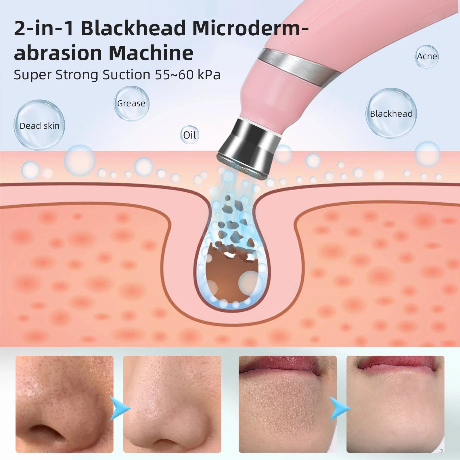 Professional Grade Microdermabrasion Machine