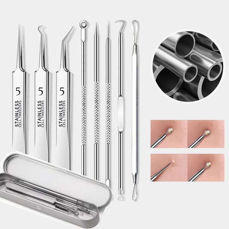 Acne Blackhead Removal Kit