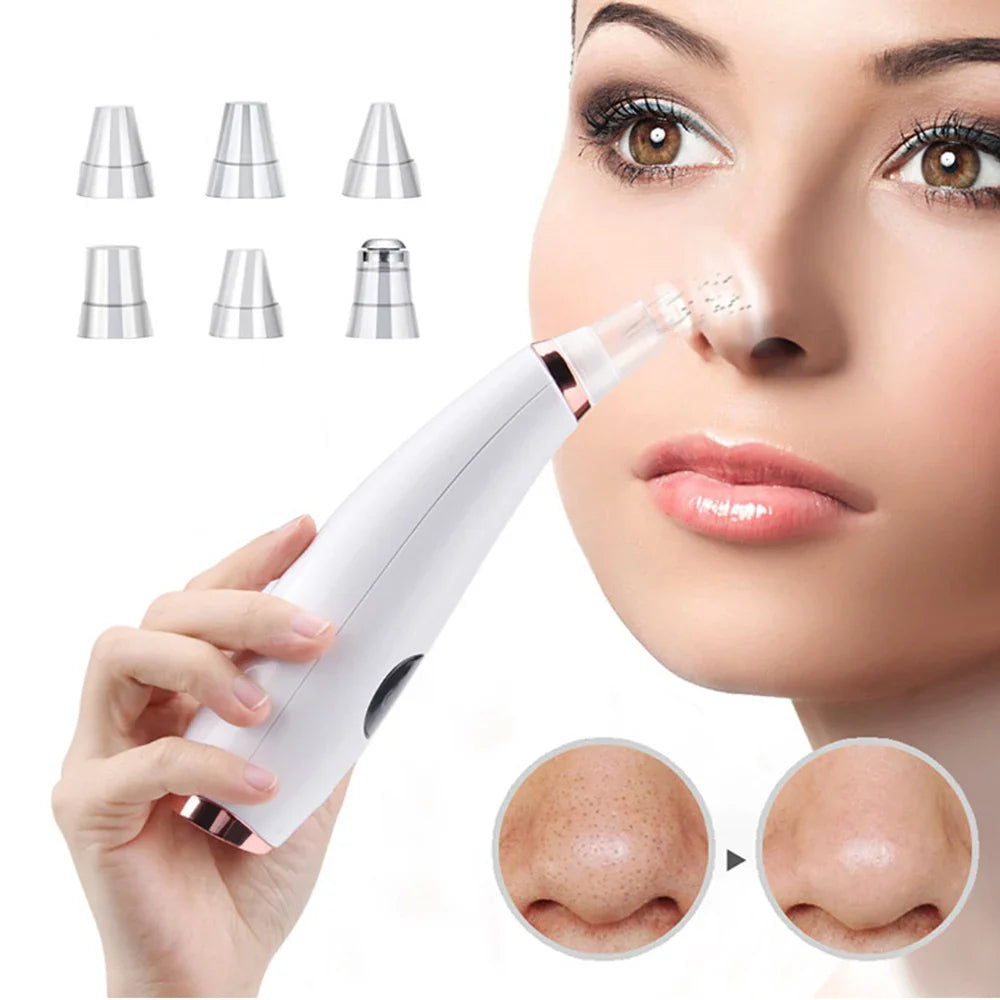 Electric Blackhead Remover Vacuum