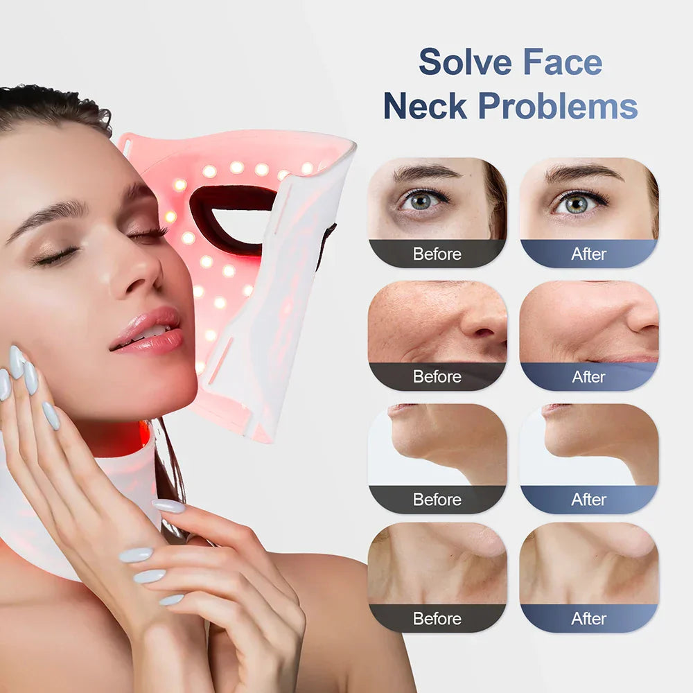 Wireless Rejuvenation Face Mask