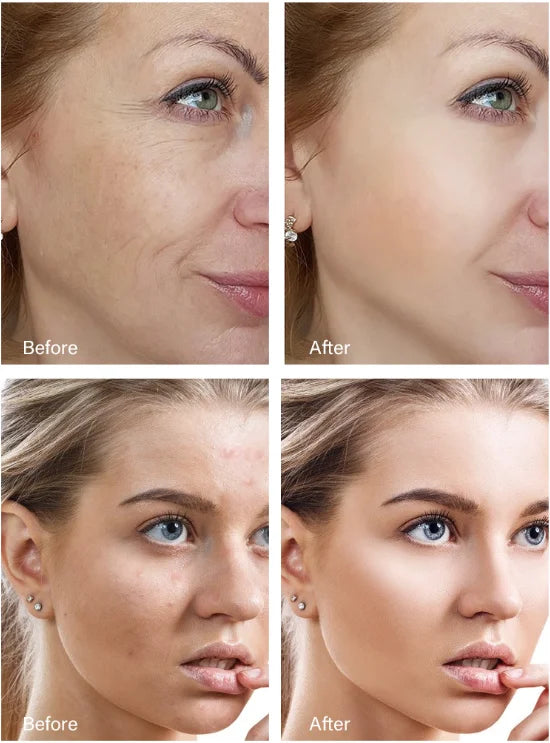 Retinol Wrinkle Remover