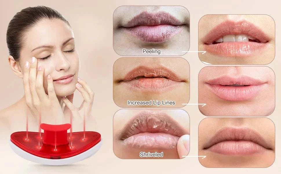 Lip Plumper Red Light Therapy
