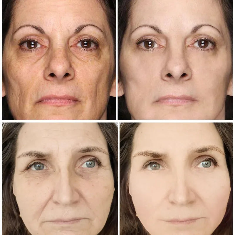 Retinol Wrinkle Remover