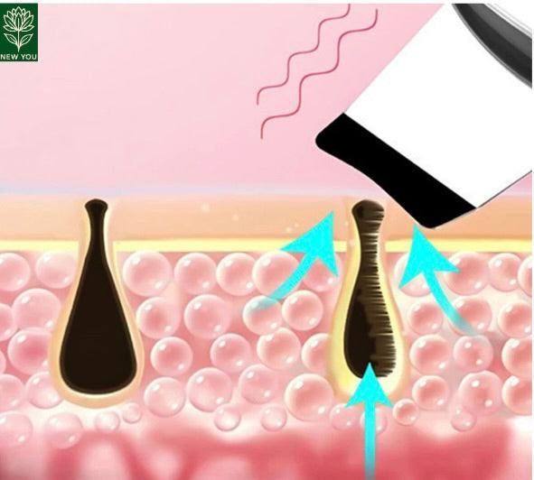 Ultrasonic Skin Scrubber