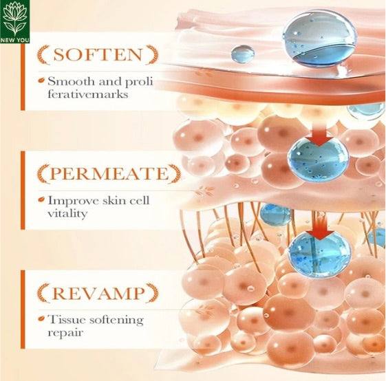 Permanent Stretch Marks Removal Cream