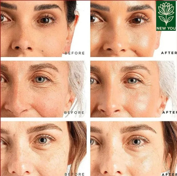 Retinol Wrinkle Remover