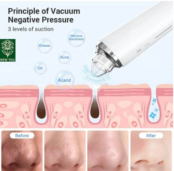 Multifunctional Beauty Cleaner – App Control & Visual Pore Camera