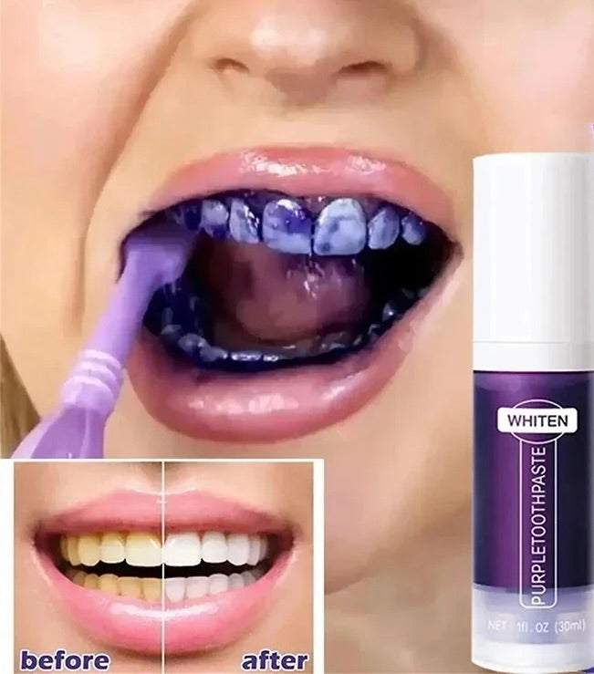 Purple Teeth Whitening Toothpaste