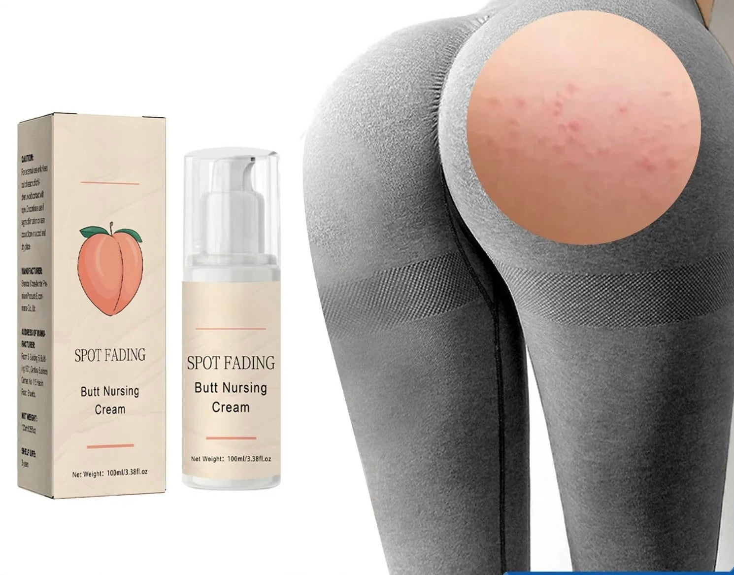 Butt Acne Cream