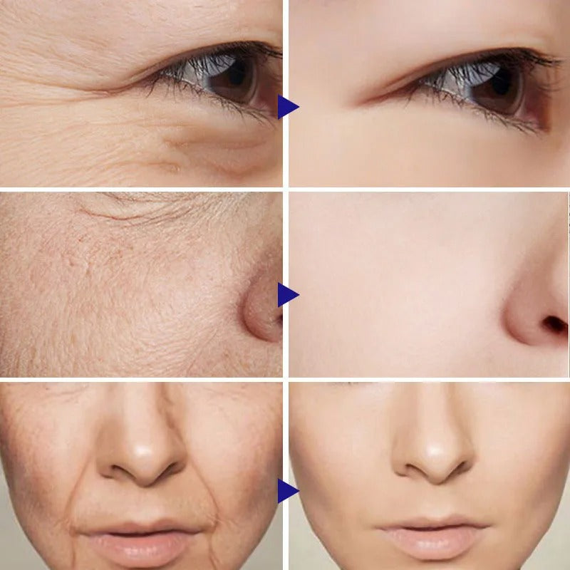 Retinol Wrinkle Remover Face Cream