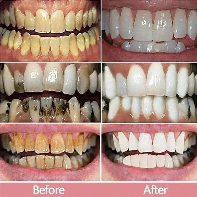 Purple Teeth Whitening Toothpaste