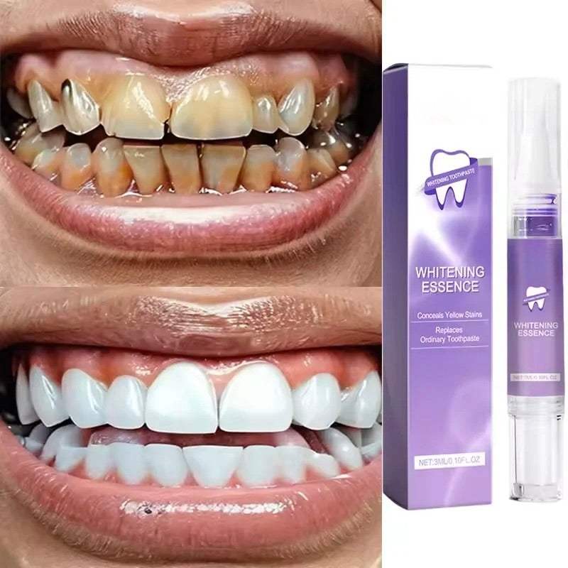 Magical Teeth Whitening Pen