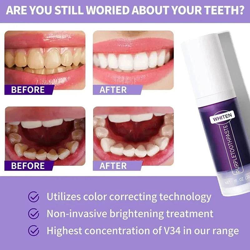 Purple Teeth Whitening Toothpaste