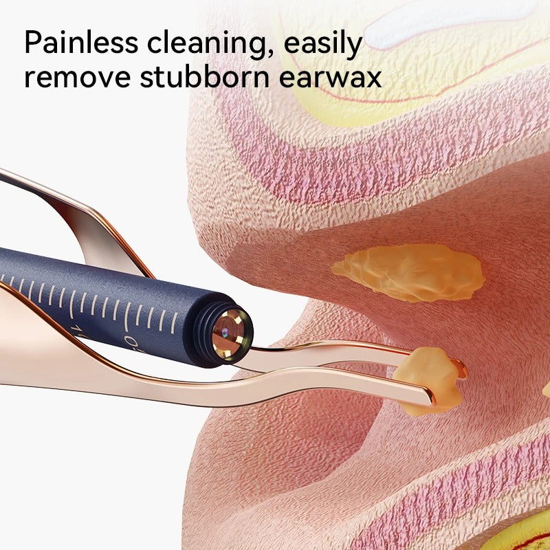 Smart Visual Ear Wax Cleaner