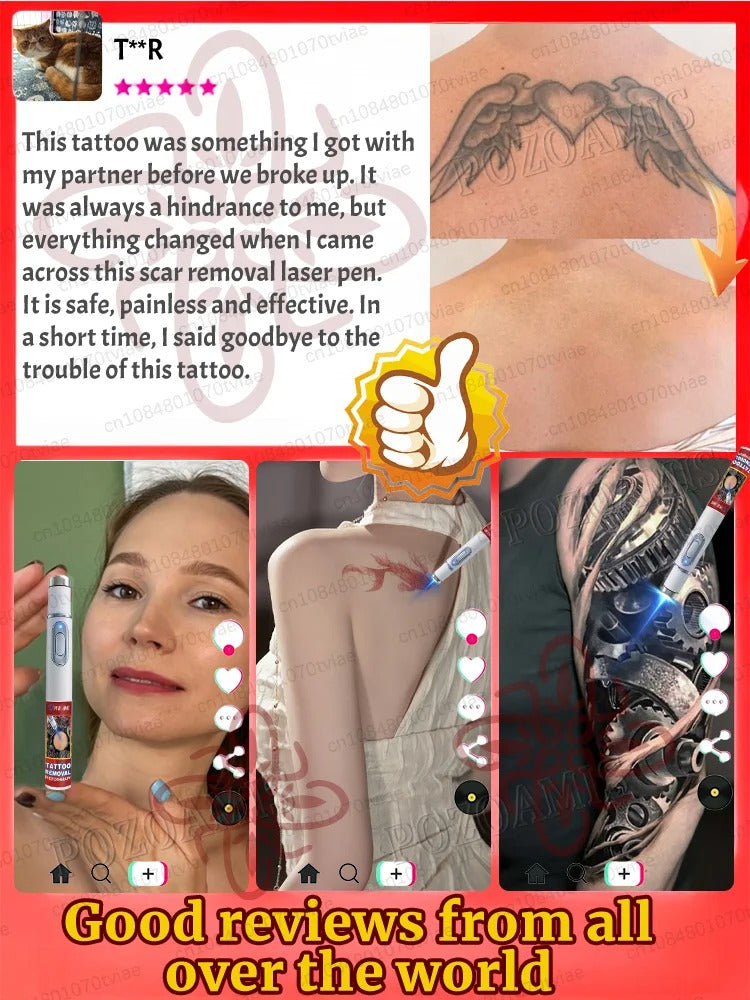 Tattoo Removal Laser Pen