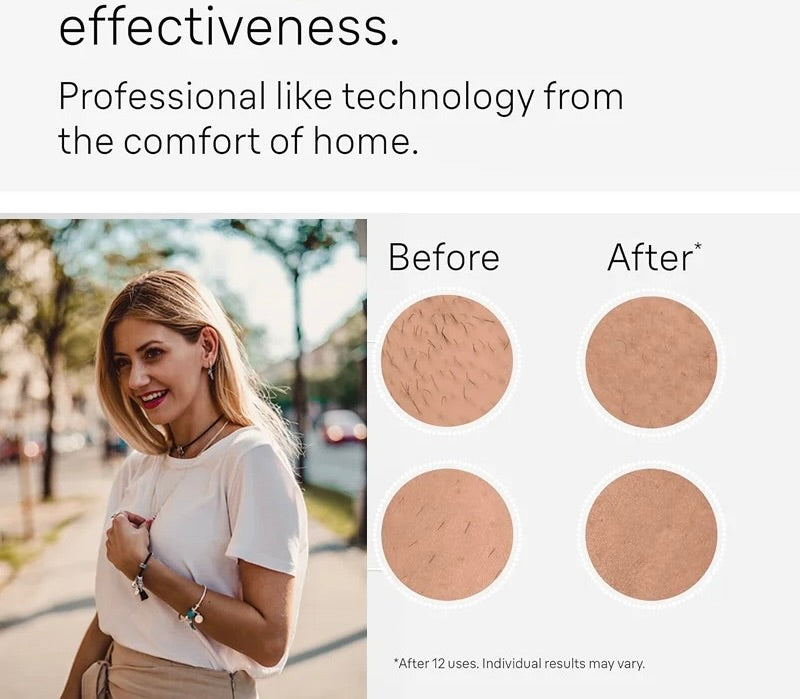 Permanent Laser Hair Removal