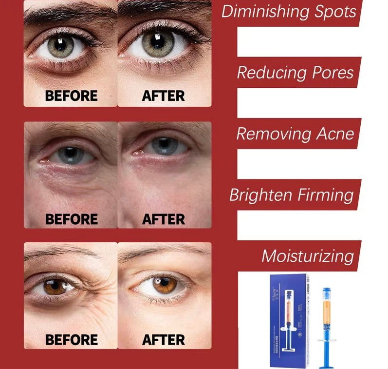 Retinol Wrinkle Remover Face Cream