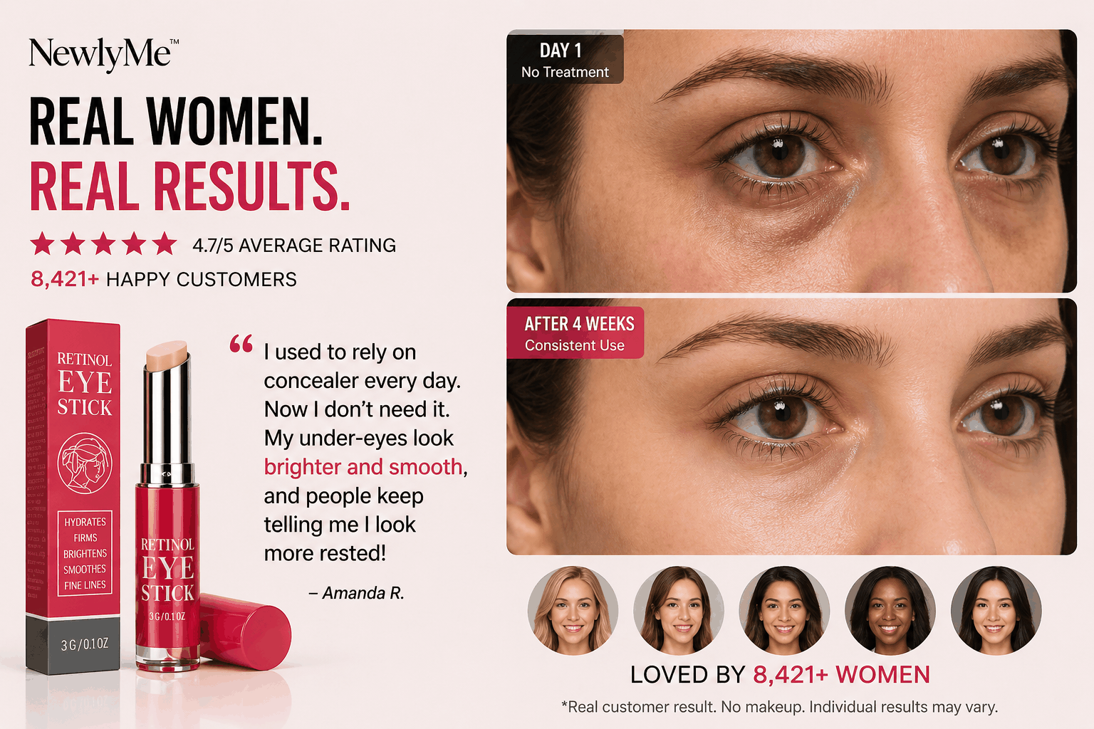 Retinol Eye Stick product with before and after effects on eyes, featuring customer testimonials.
