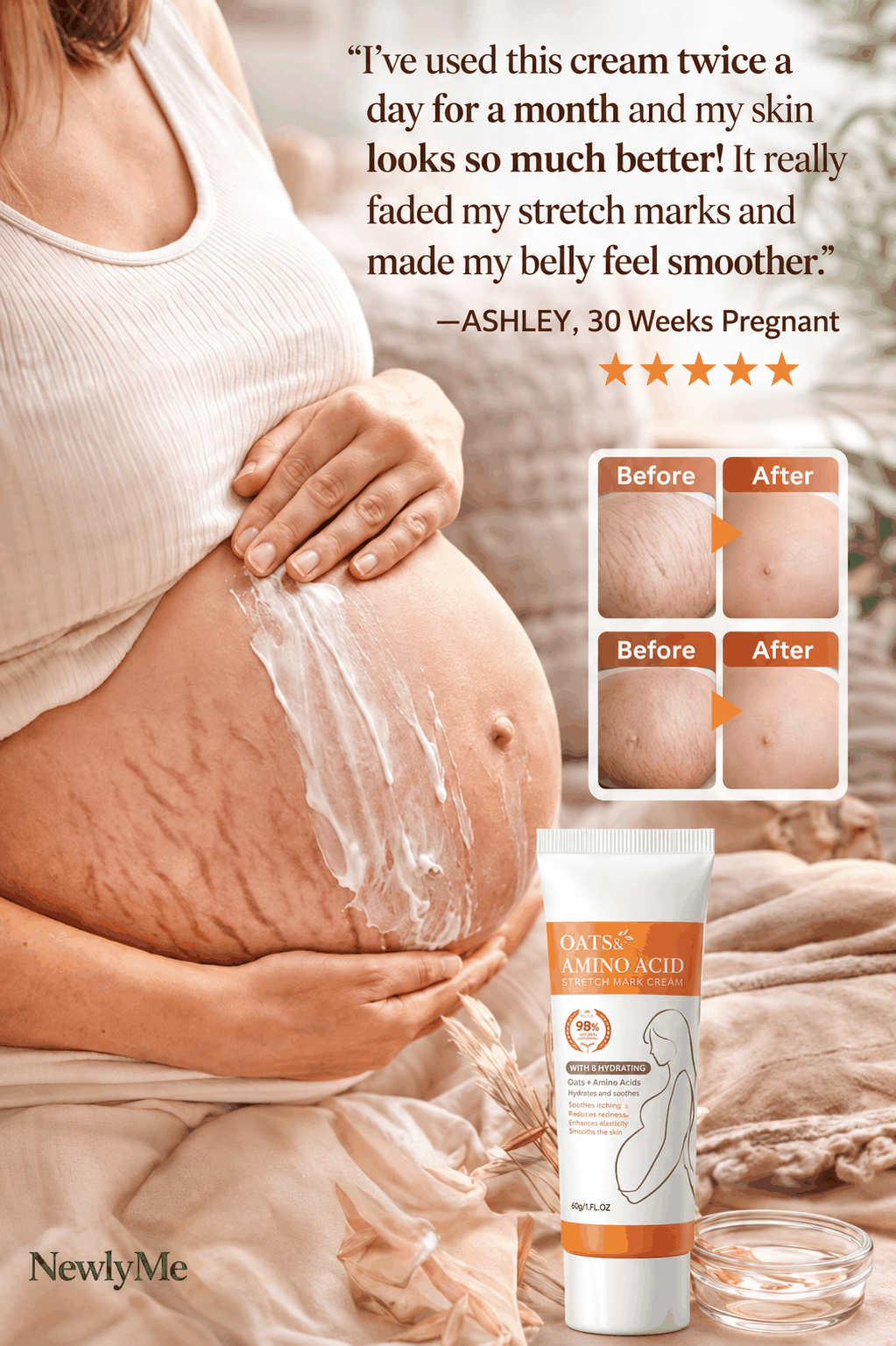 maternity cream