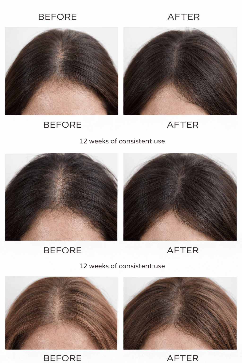 Anti Hair Loss Therapy Comb