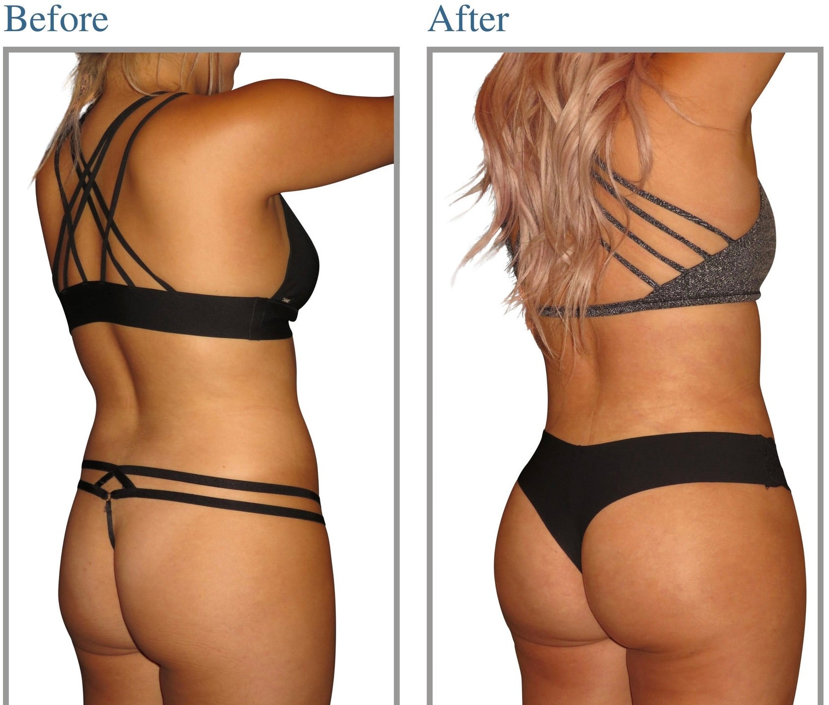 Electric Buttocks Muscle Toner