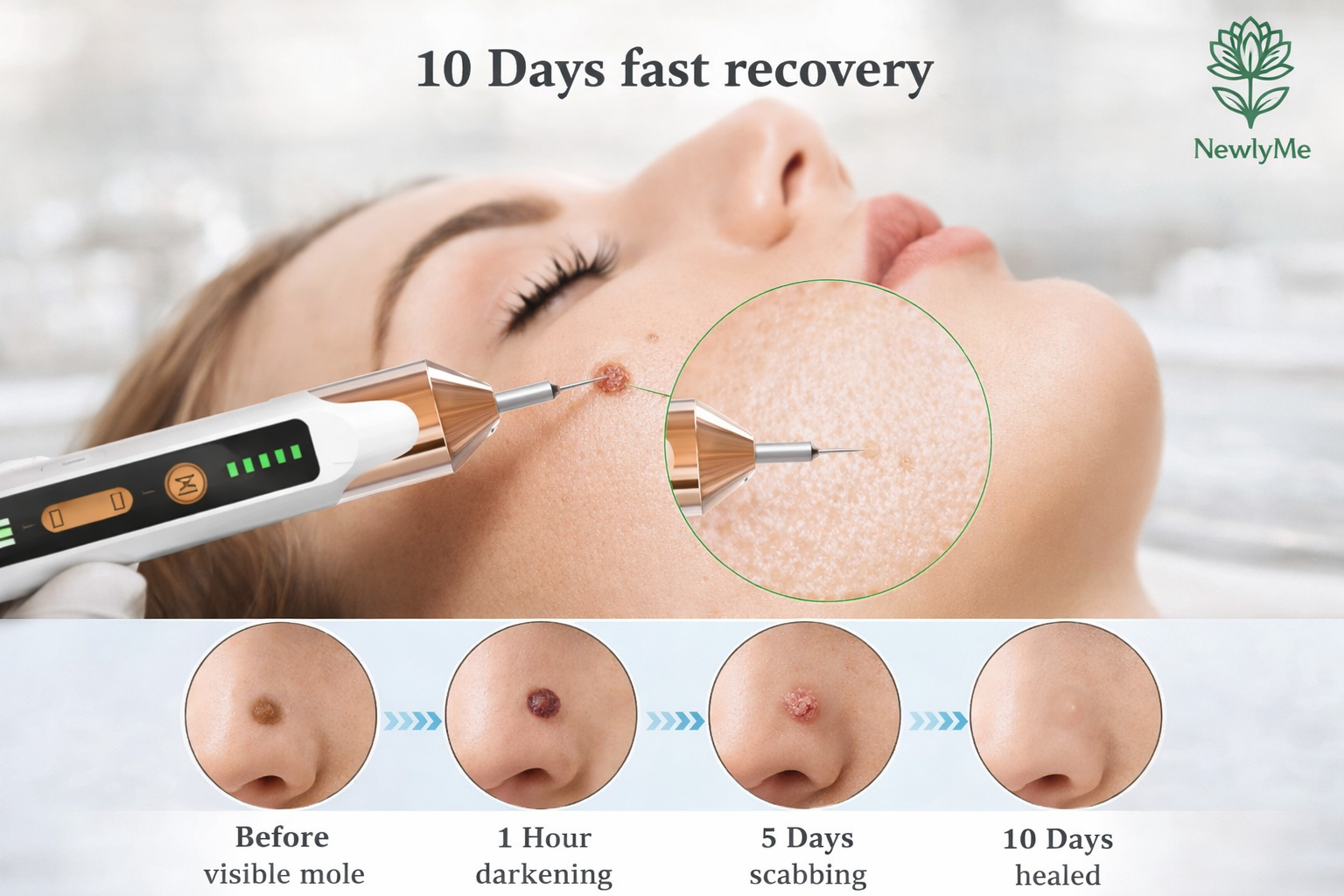 Skin Tag Remover
