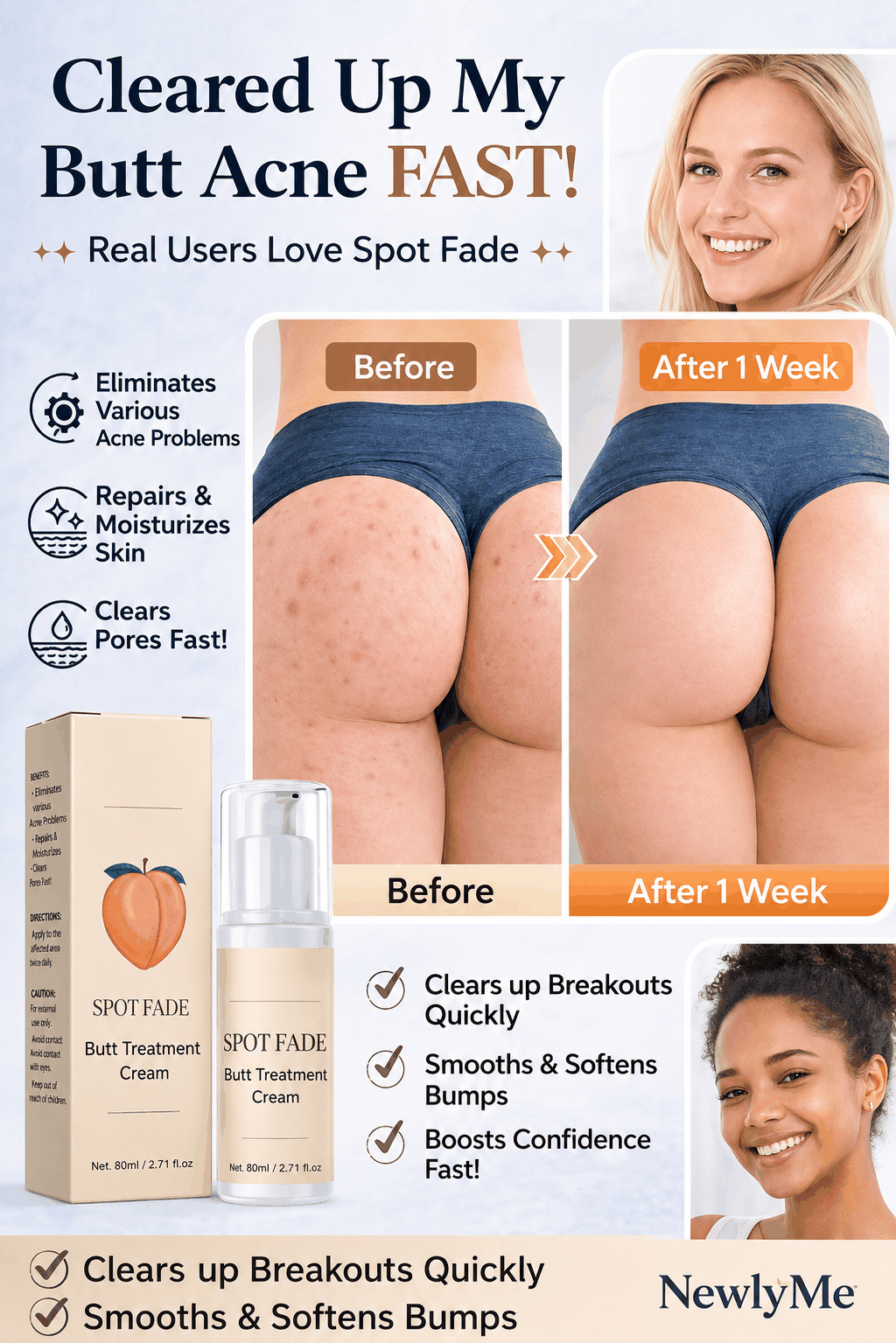 Butt acne cream for clearing bumps and soothing irritation