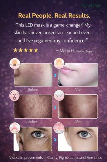 7 Color Photodynamic Therapy Face Mask