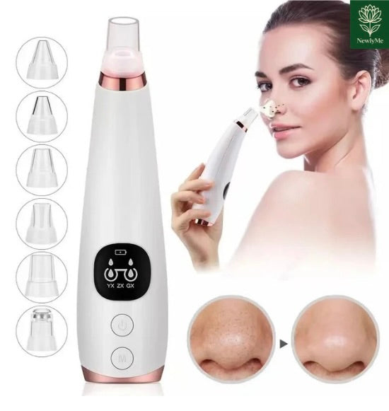 Electric Blackhead Remover Vacuum with multiple suction heads for clear skin and reduced pores