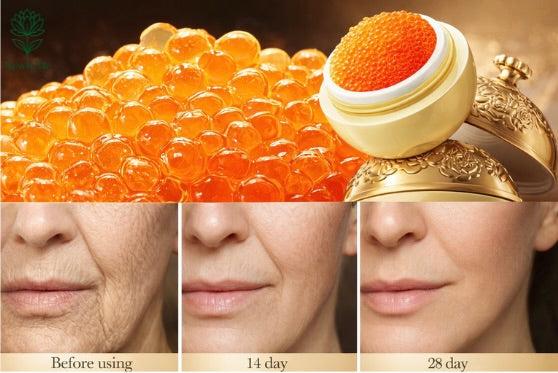 Luxury Caviar Essence Anti-aging Cream Wrinkle Removal Collagen Firming Lifting Elastic Facial  Skin Care Korean Cosmetics 30g