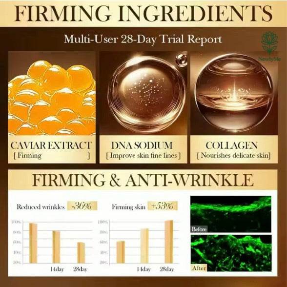 Luxury Caviar Essence Anti-aging Cream Wrinkle Removal Collagen Firming Lifting Elastic Facial  Skin Care Korean Cosmetics 30g