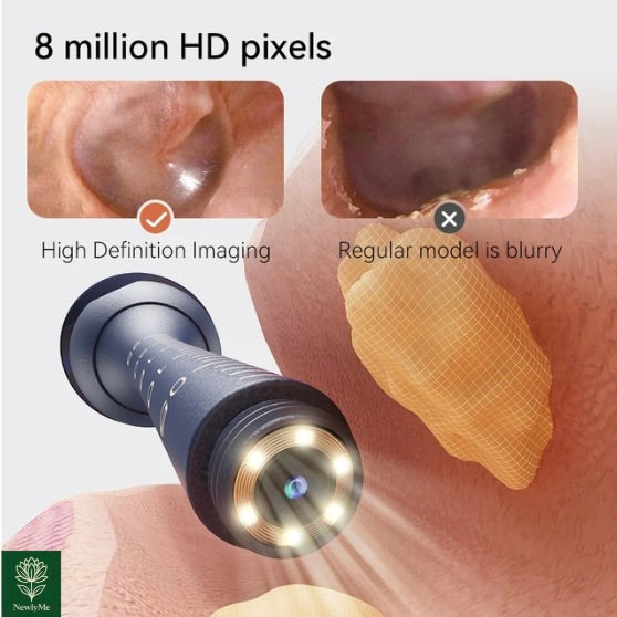 Smart Visual Ear Wax Cleaner