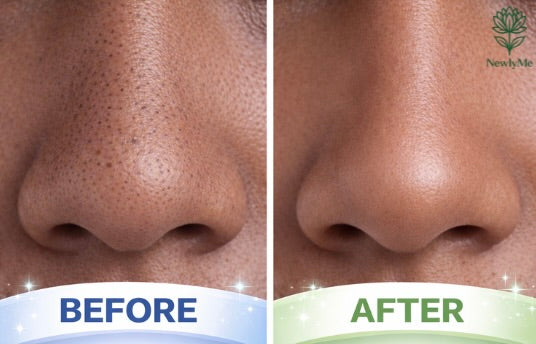 Deep Cleansing Charcoal Nose Strips