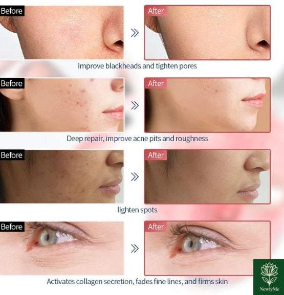 Anti-Aging Beauty Mask