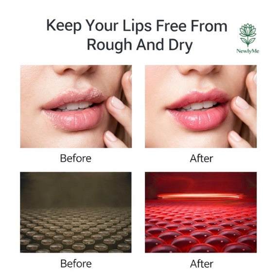 Led Lip Therapy