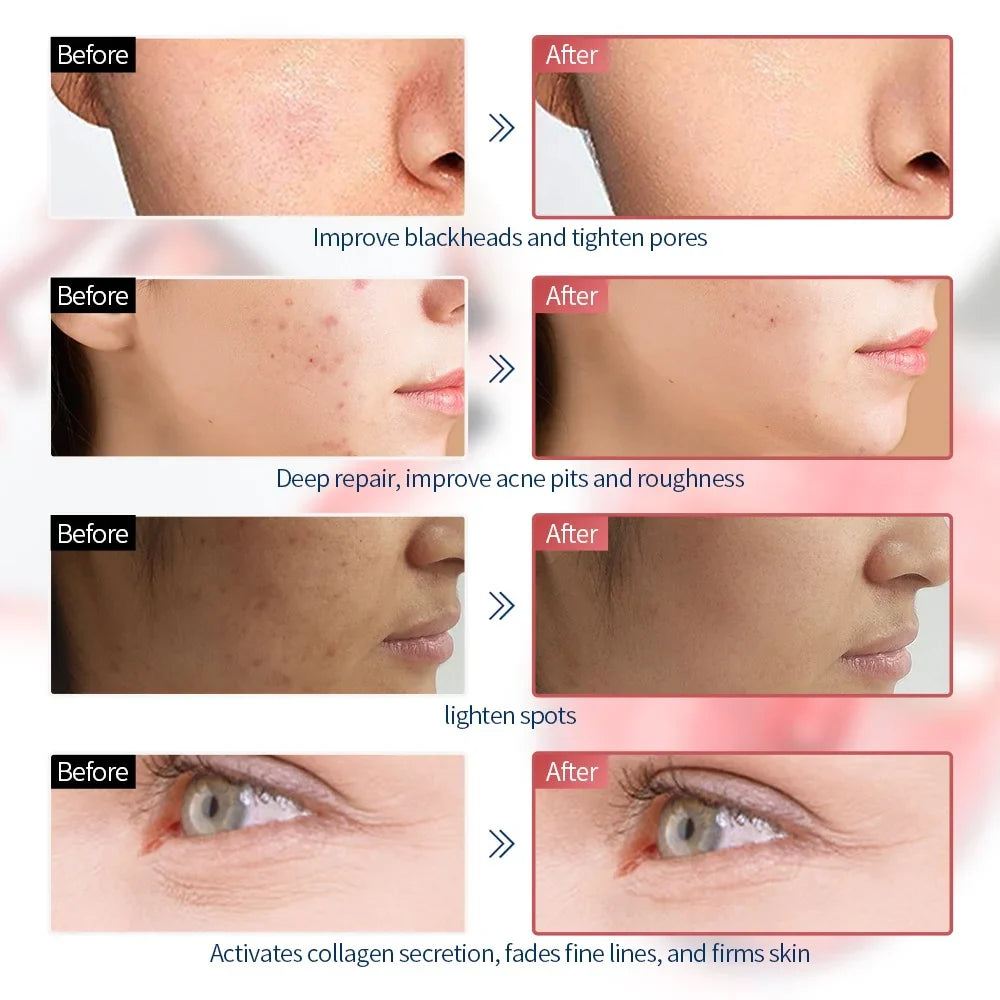 Anti-Aging Beauty Mask