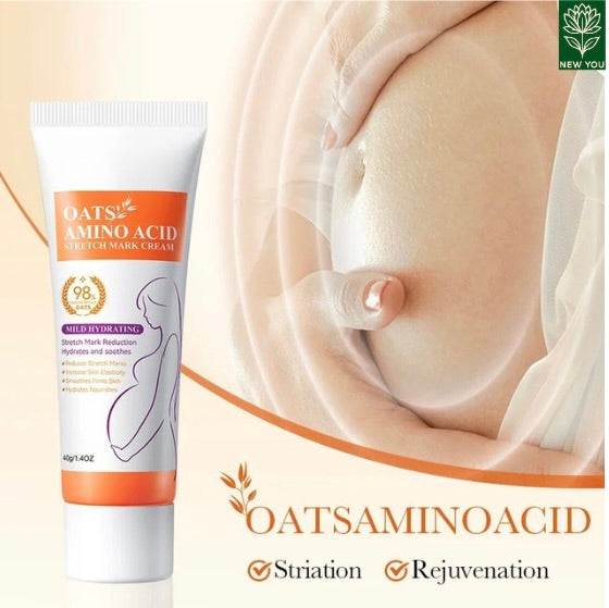 Permanent Stretch Marks Removal Cream