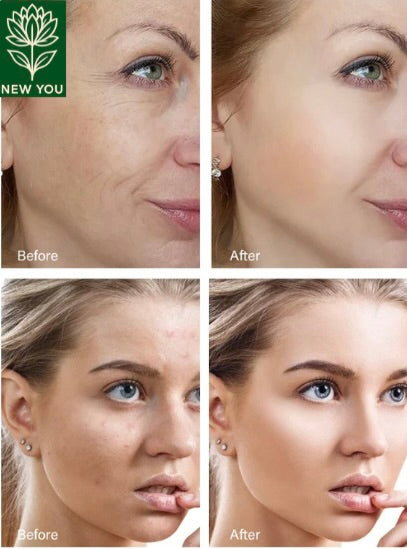 Retinol Wrinkle Remover