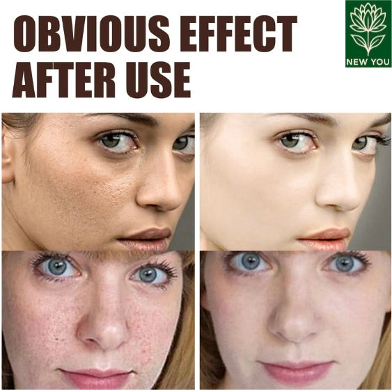 Retinol Wrinkle Remover