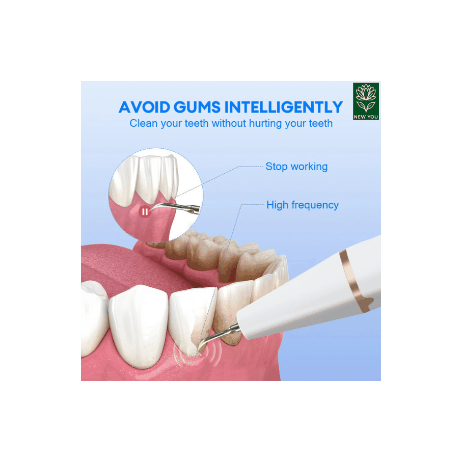 Dental scaler cleaning teeth with high-frequency sound waves to remove tartar and stains safely without damaging gums.