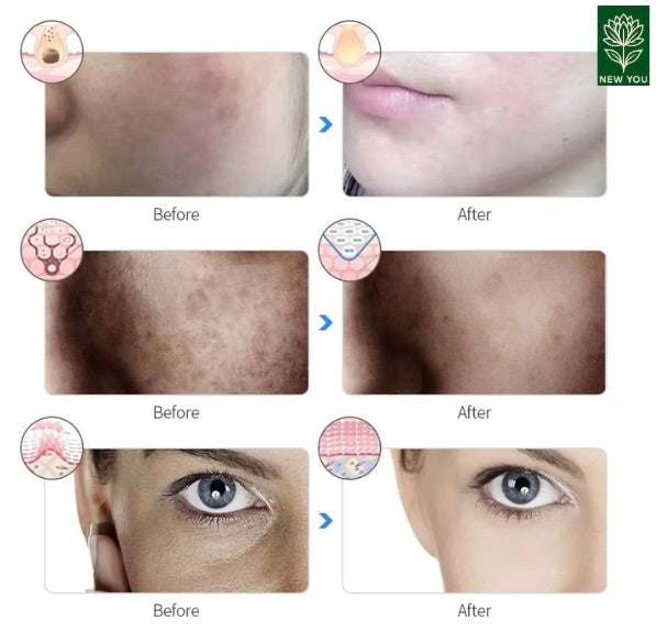 7 Color Photodynamic Therapy Face Mask